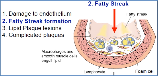 fatty streak formation in atherosclerosis