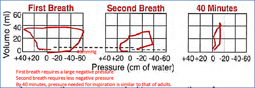 Neonatal Respiratory Transition - First breaths