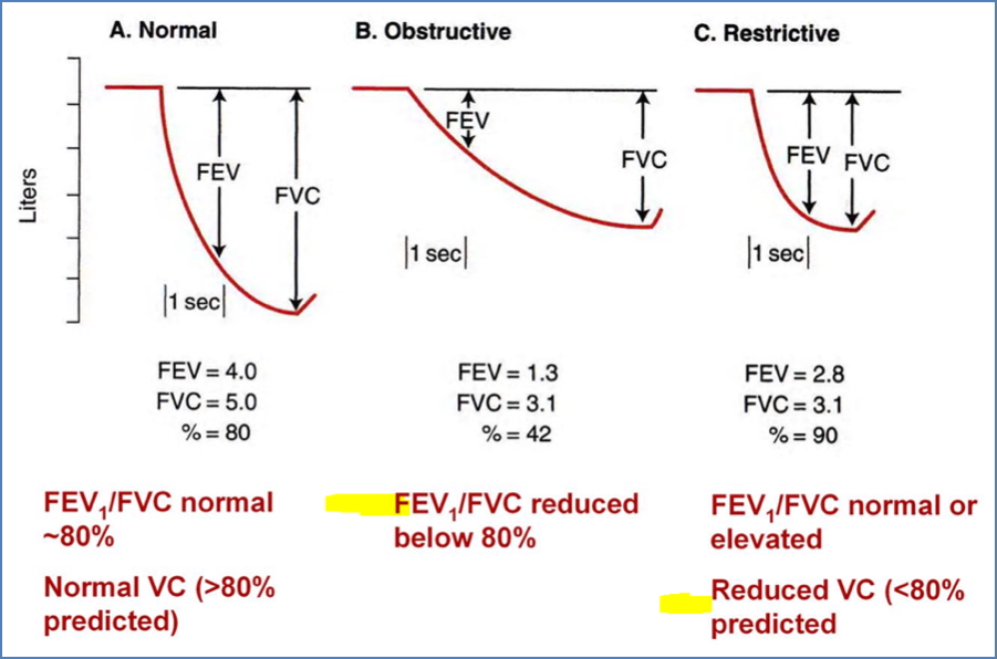 Spirometry of Obstructive vs Restrictive Lung Disorders