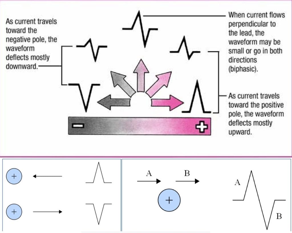 Understanding the Physiology of ECG Waveforms