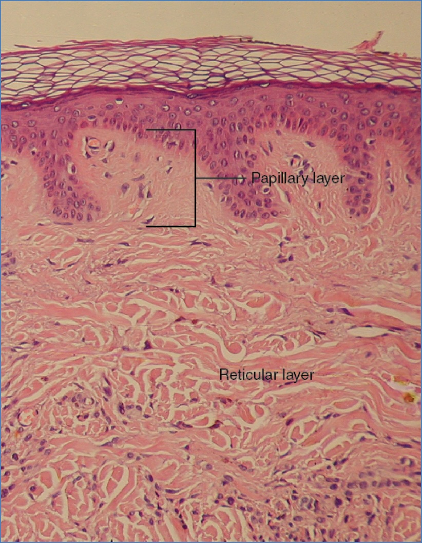 Basic Structure of Normal Skin