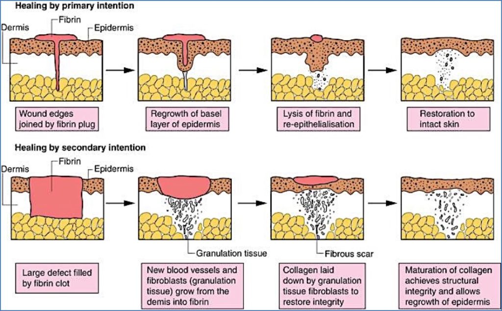 Skin Healing By Primary Intention