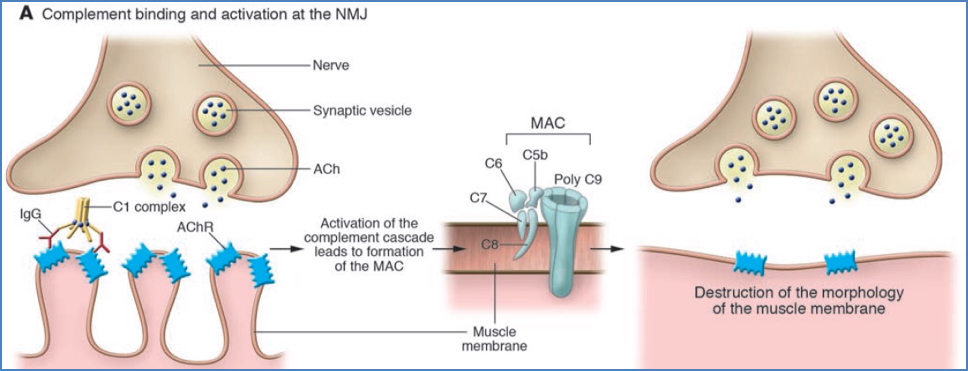 MYASTHENIA GRAVIS pathophysiology