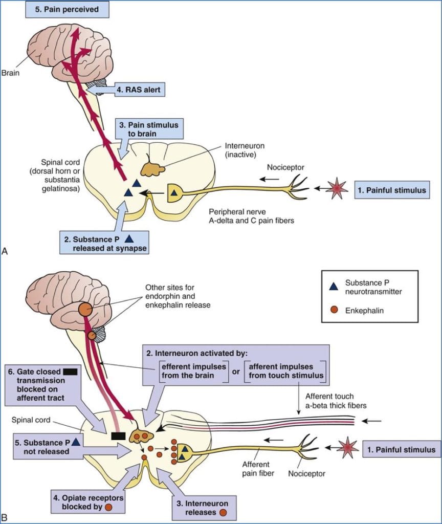 Pain gate mechanism - Opiate receptors