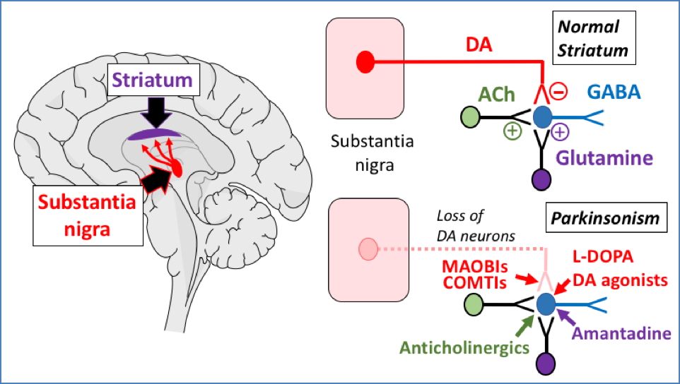 PARKINSON’S disease treatment