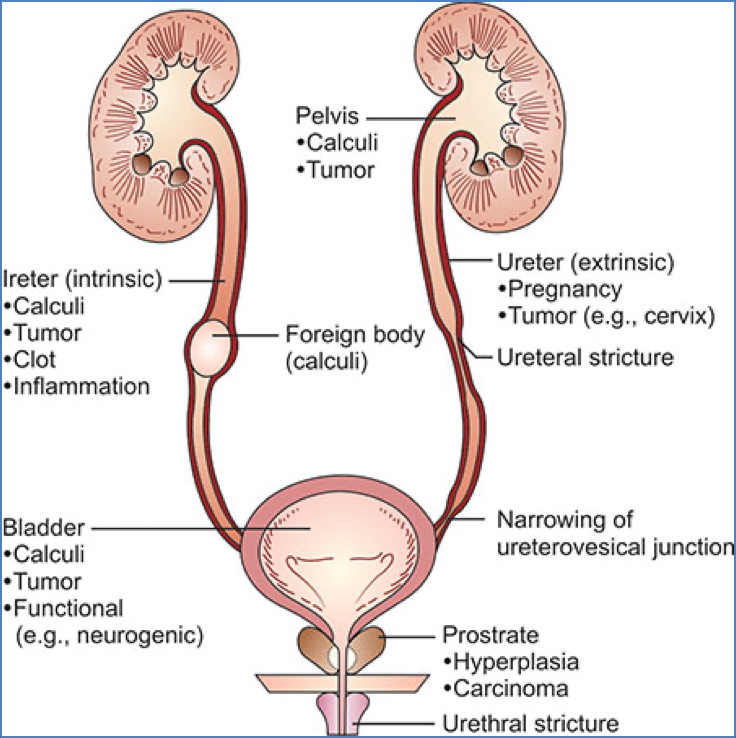 POST-RENAL FAILURE