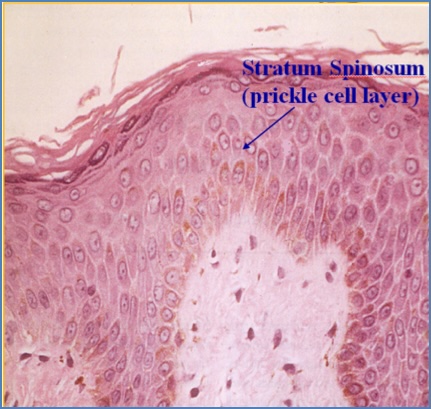 Skin structure - Stratum Spinosum