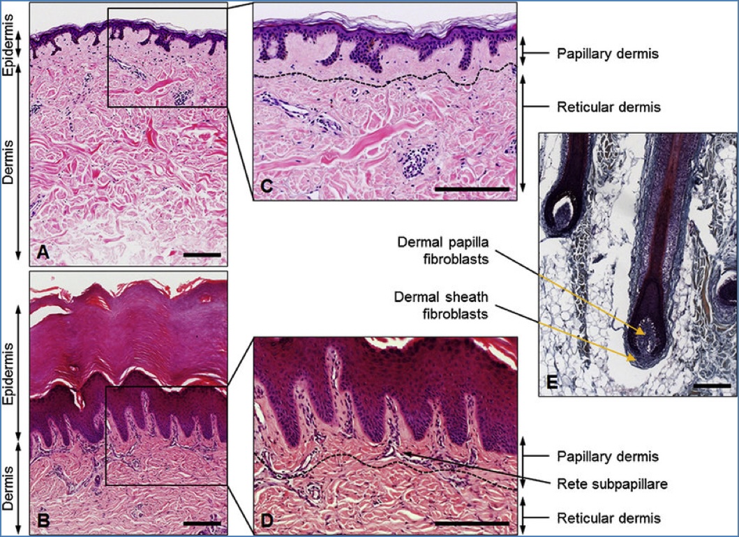 Structure of the skin - Dermis