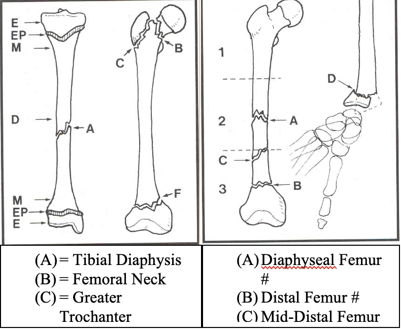 bony injuries - Which part of the bone is fractured?
