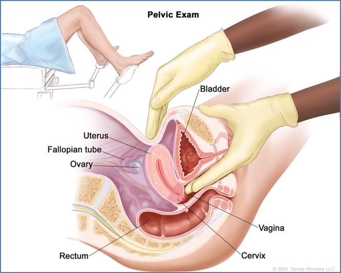 well-woman check: Bimanual Pelvic Examination