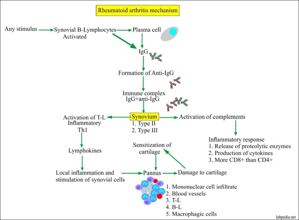 Binding of RF-IgG Complexes to Articular Cartilage