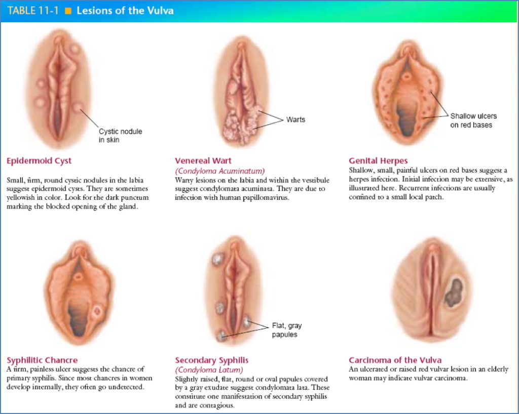 well-woman check: General Inspection & Palpation