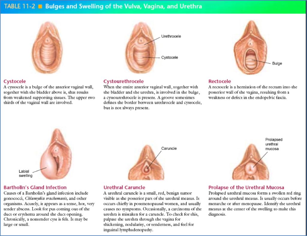 well-woman check: General Inspection & Palpation