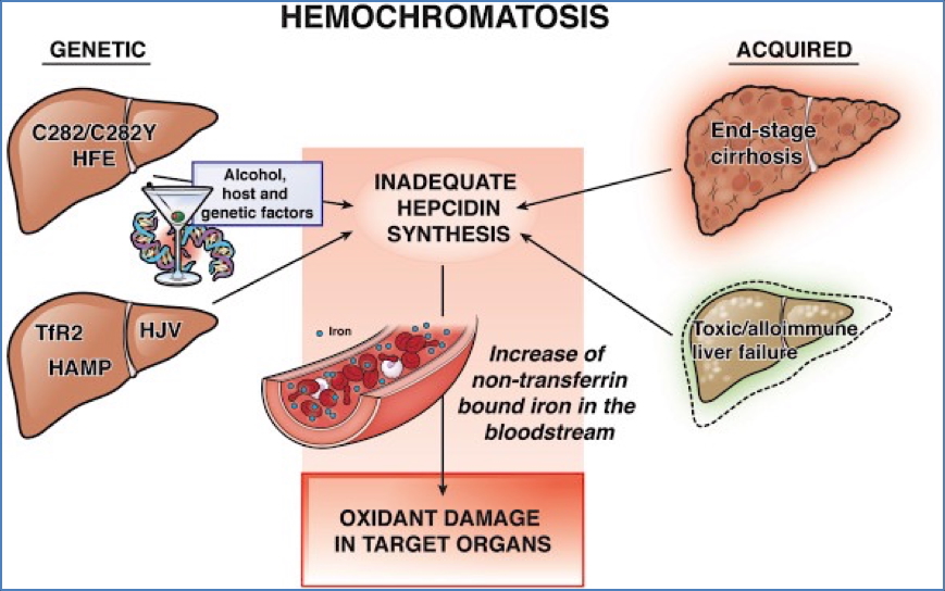 HAEMOCHROMATOSIS