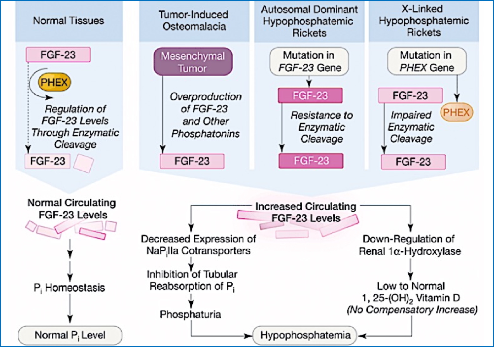 HYPOPHOSPHATEMIC RICKETS