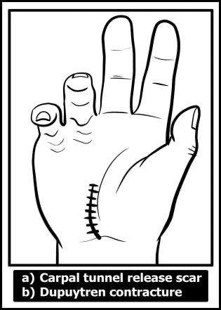 Hand exam - wrist inspection