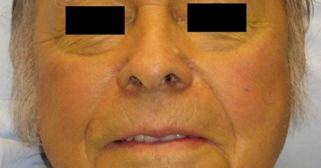 the gastrointestinal examination: Jaundice