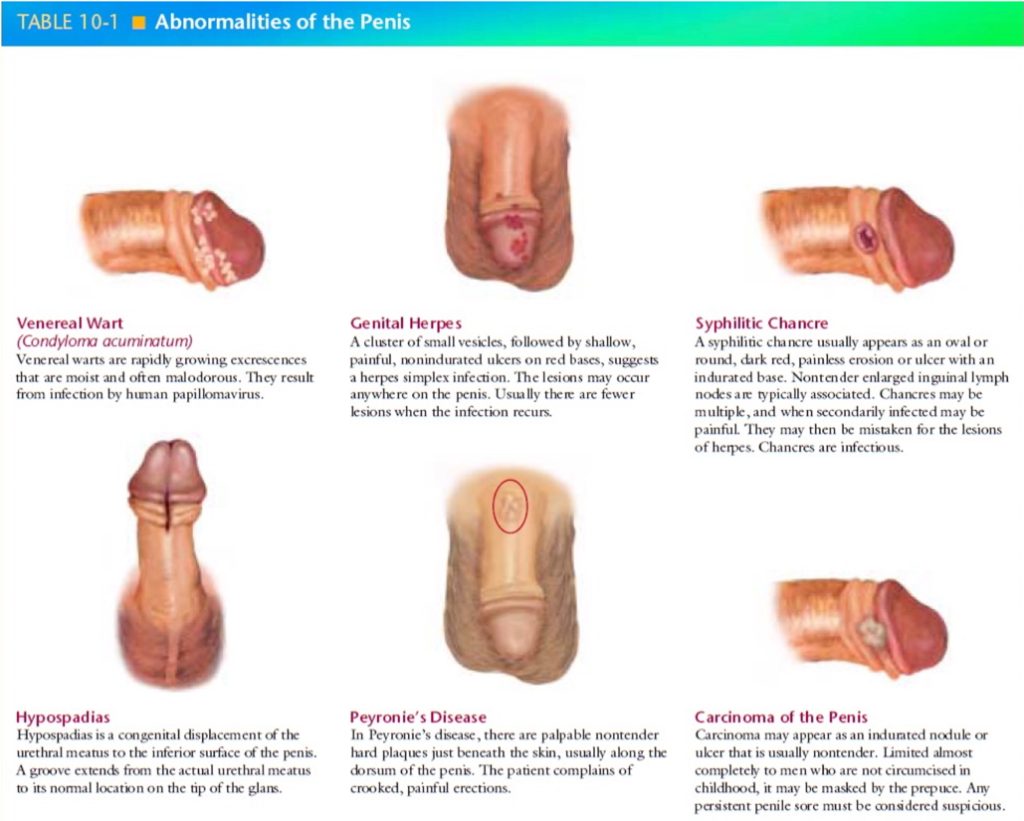 male genital exam