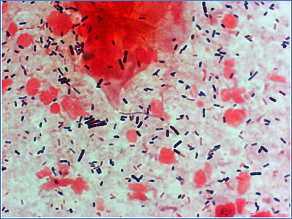 Normal Flora of the Genital Tract