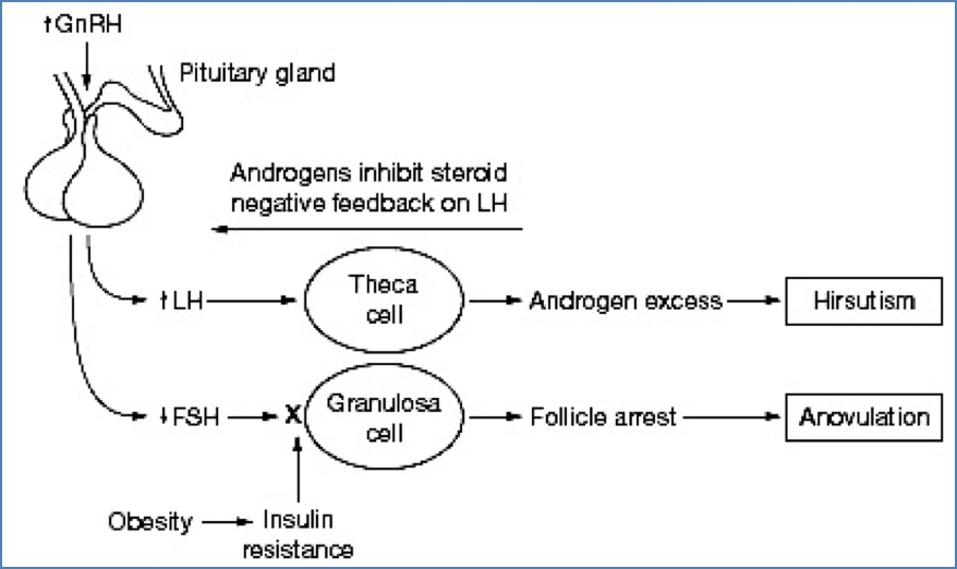 POLYCYSTIC OVARIAN SYNDROME