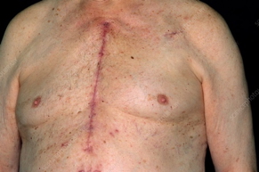 the cardiovascular examination: Surgical Scars