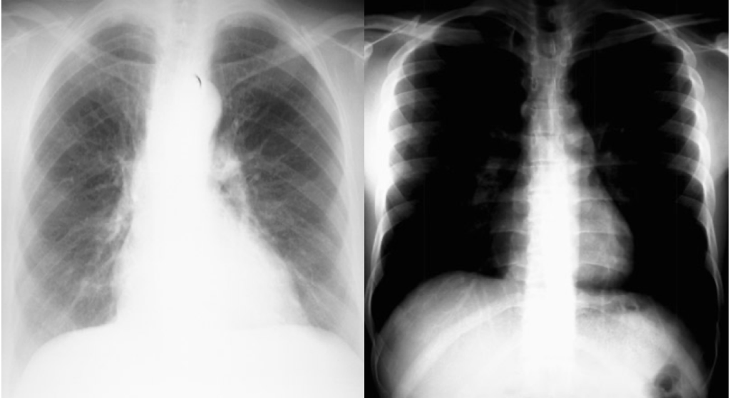 System for Examining Chest X-Rays