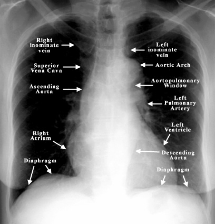 System for Examining Chest X-Rays2