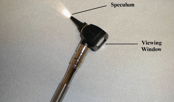 The Otoscope