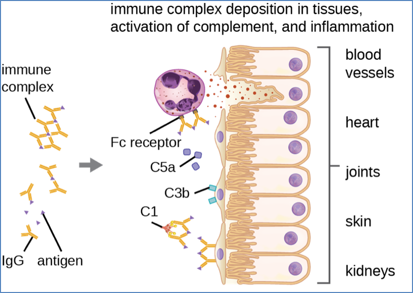 Type-III Hypersensitivity