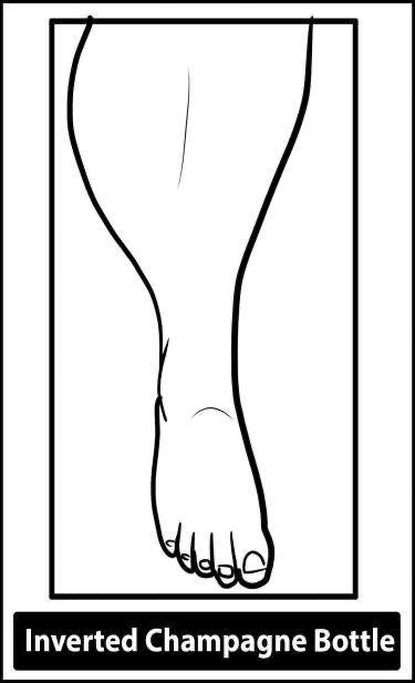 Venous Vascular Exam - Champagne Bottle